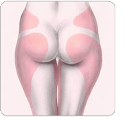 liposukcija